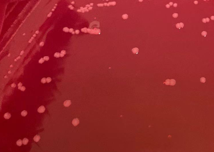 甲型副伤寒沙门菌CMCC50093 无色菌落，无黑心